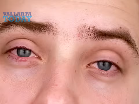 alergias