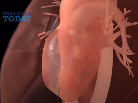 avances cardiologia