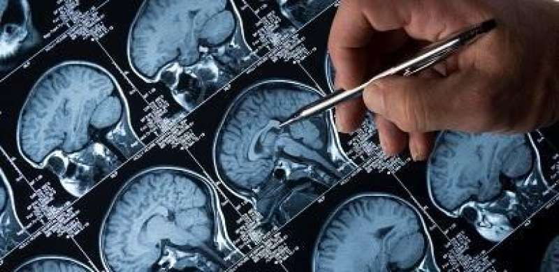 New technology can predict Alzheimer’s two years before doctors