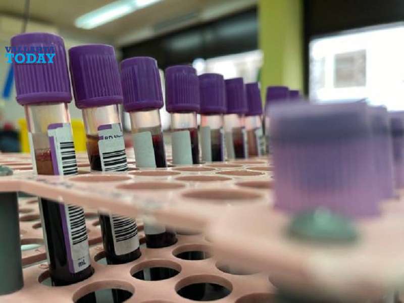The State Of Jalisco Performs Its Own Diagnostic Tests For Mpox