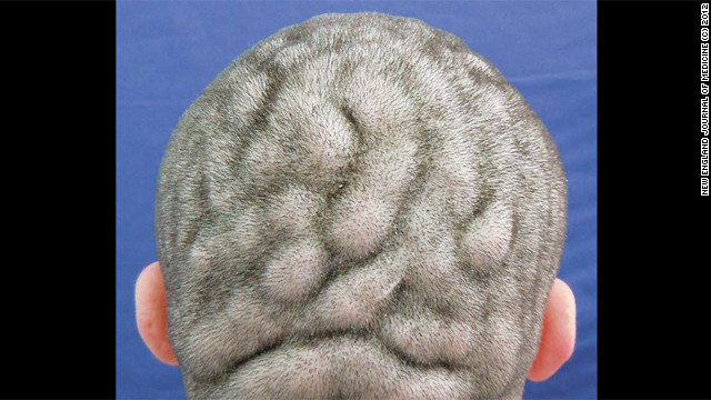 rarecondition